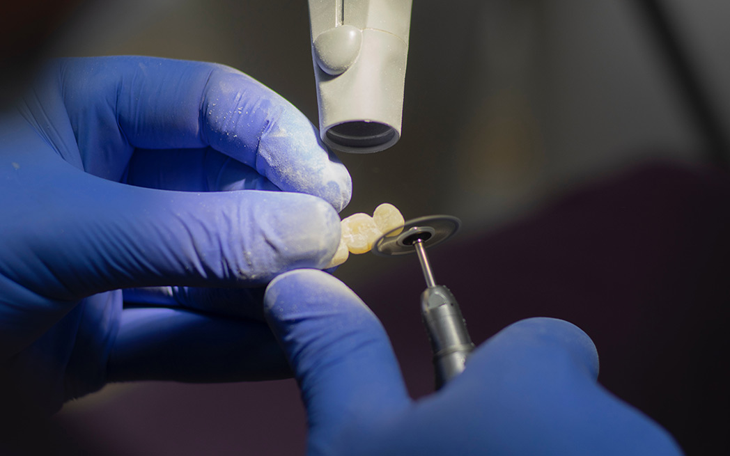 dental-crown-elena-mozhvilo-unsplash